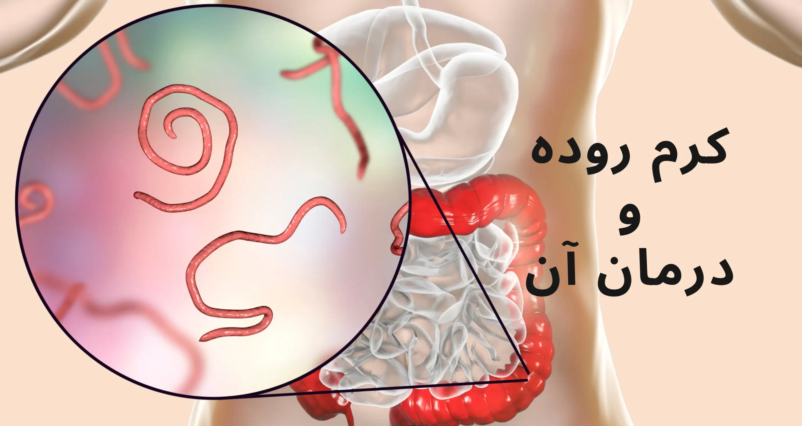 کرم روده و درمان آن