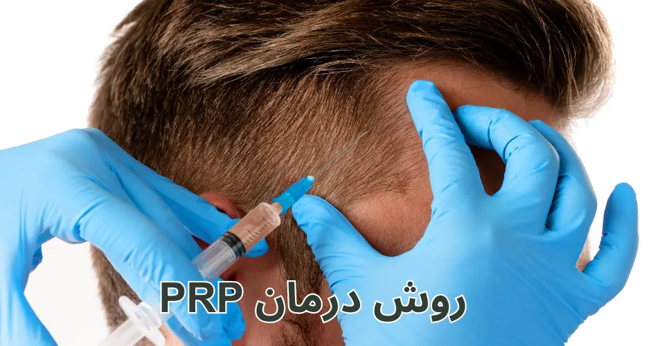 روش درمان PRP