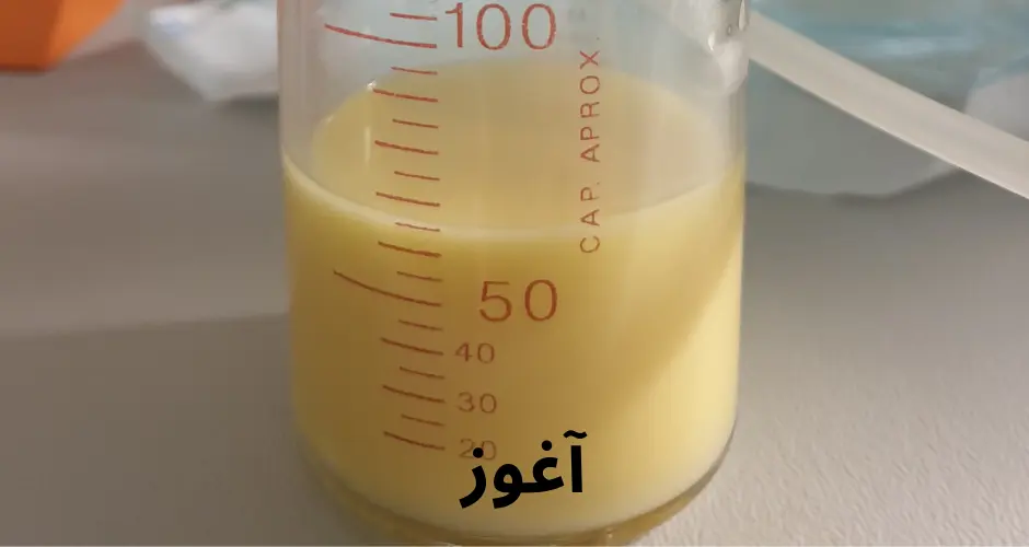 آغوز